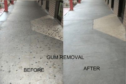 Gum Removal 