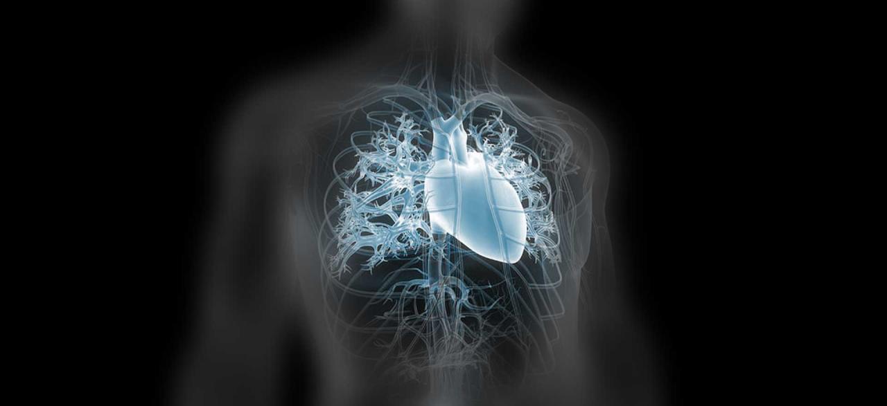 What is Coronary Artery Disease?