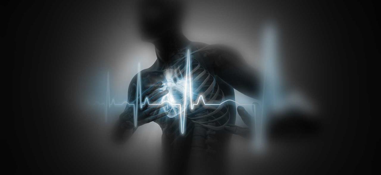 What is a Heart Attack?