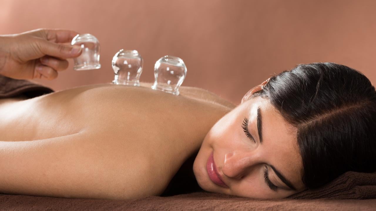 Cupping Therapy