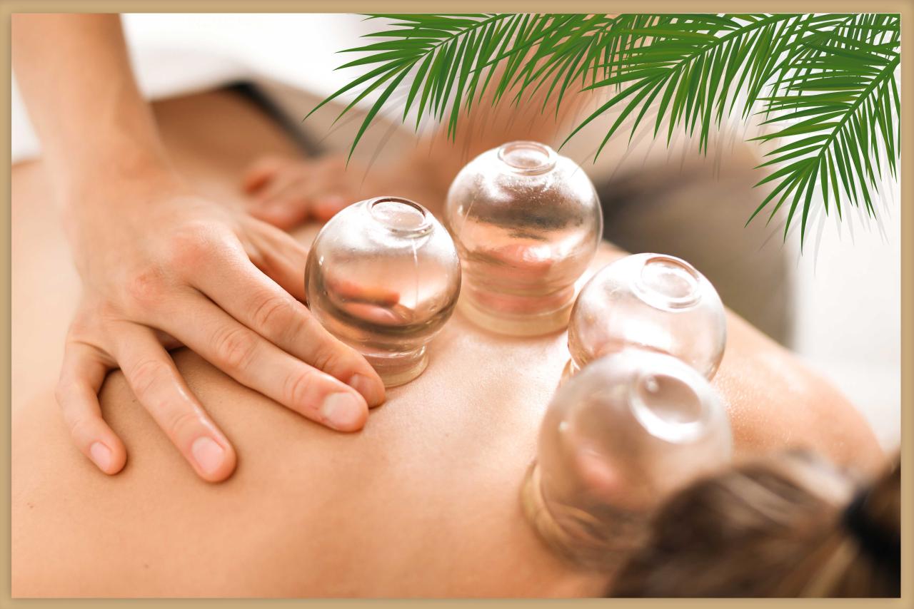 Cupping Therapy